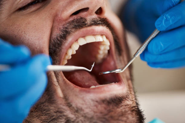 Best Same-Day Emergency Dental Services in Wenona, IL